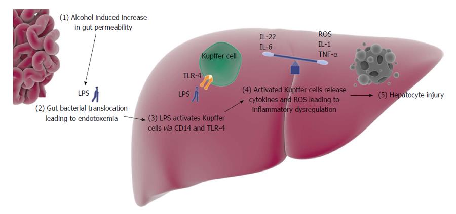 Alcoholic hepatitis: The pivotal role of Kupffer cells