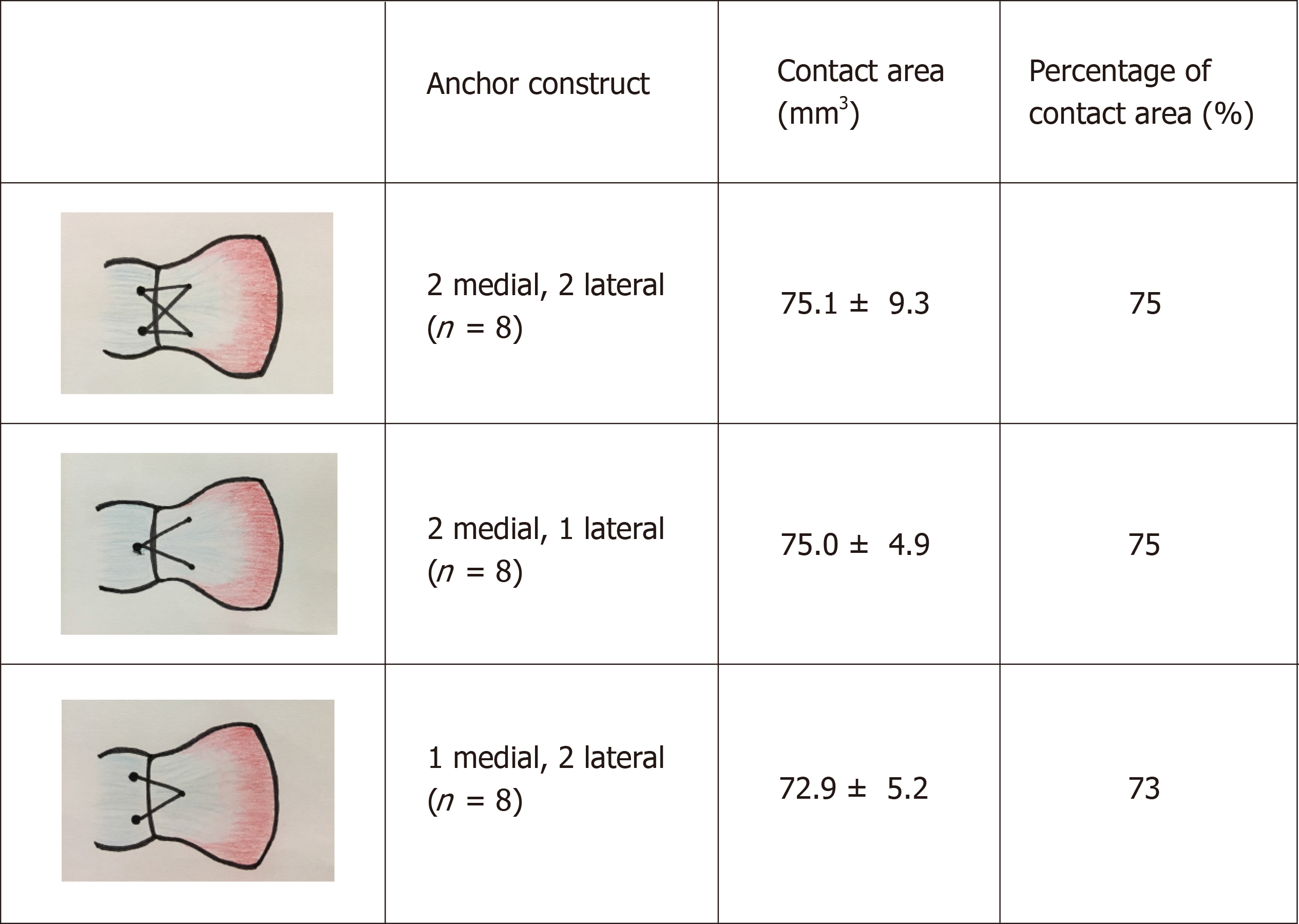 Double row Repair Of Rotator Cuff Tears Comparing Tendon Contact Area 