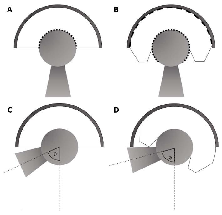 Dual mobility cups in total hip arthroplasty