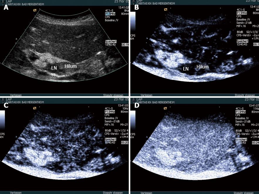 groin lymph nodes ultrasound