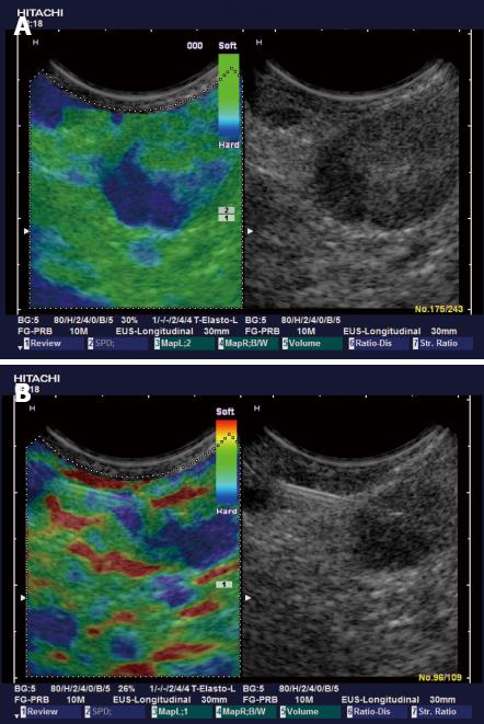 groin lymph nodes ultrasound