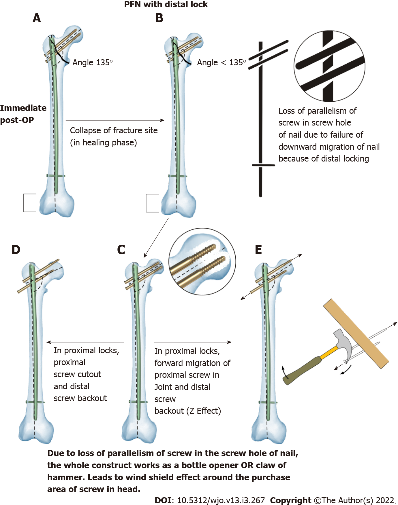 Comparative study of intertrochanteric fracture fixation using proximal  femoral nail with and without distal interlocking screws