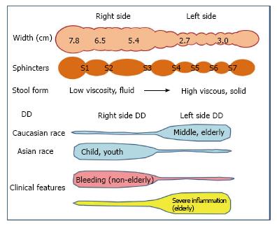 Diverticulitis Vs Diverticulosis Chart