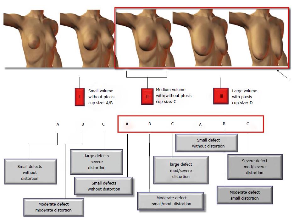 Algorithm for immediate conservative breast surgery reconstruction