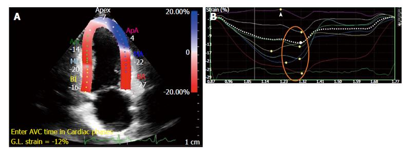 Global myocardial strain assessment by different imaging