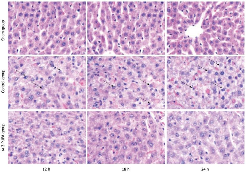 Healthy Diet For Liver Regeneration After Partial Hepatectomy