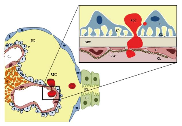 Pathogenesis Of Glomerular Haematuria 3996