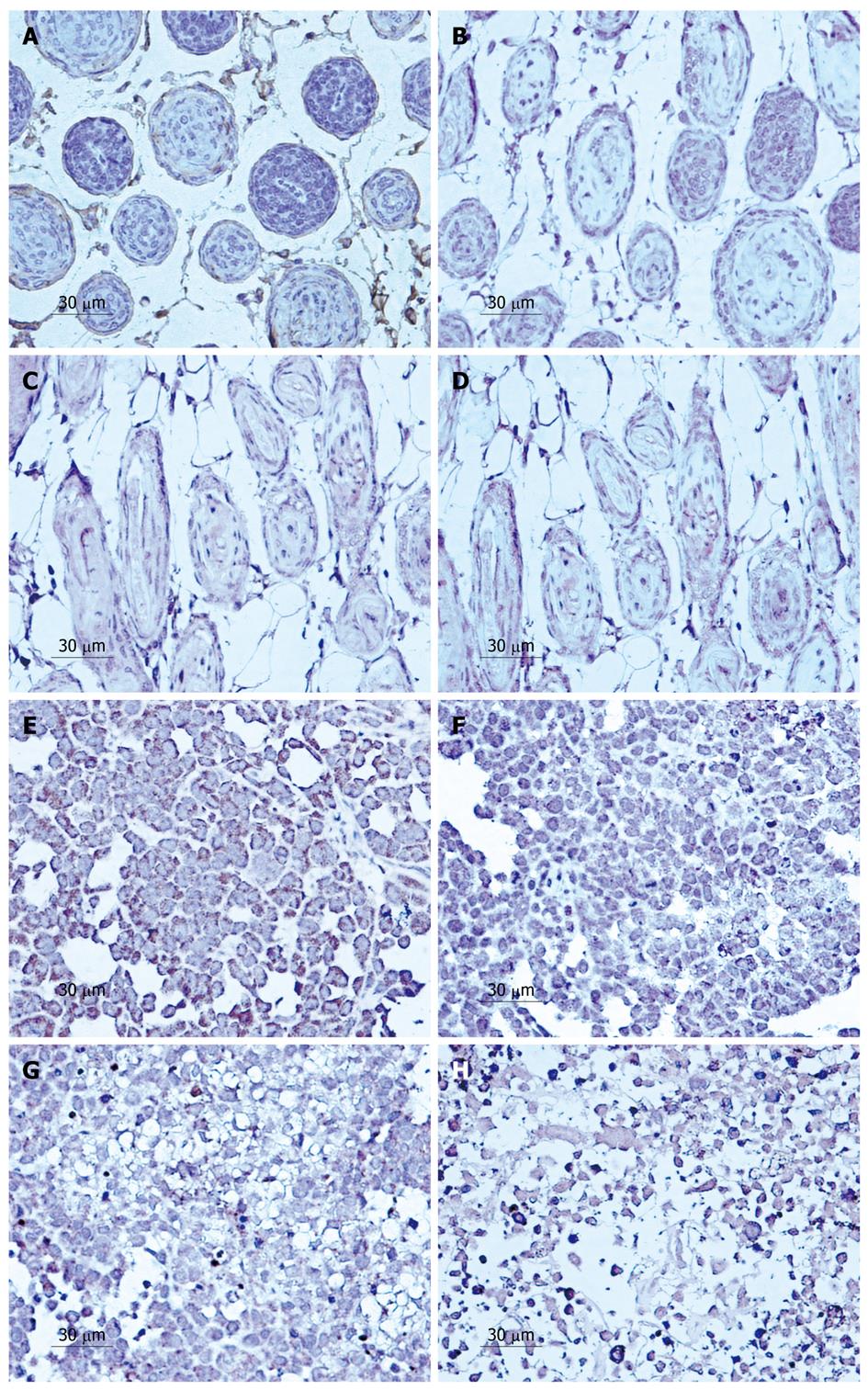 Effects of LY294002 on the invasiveness of human gastric 