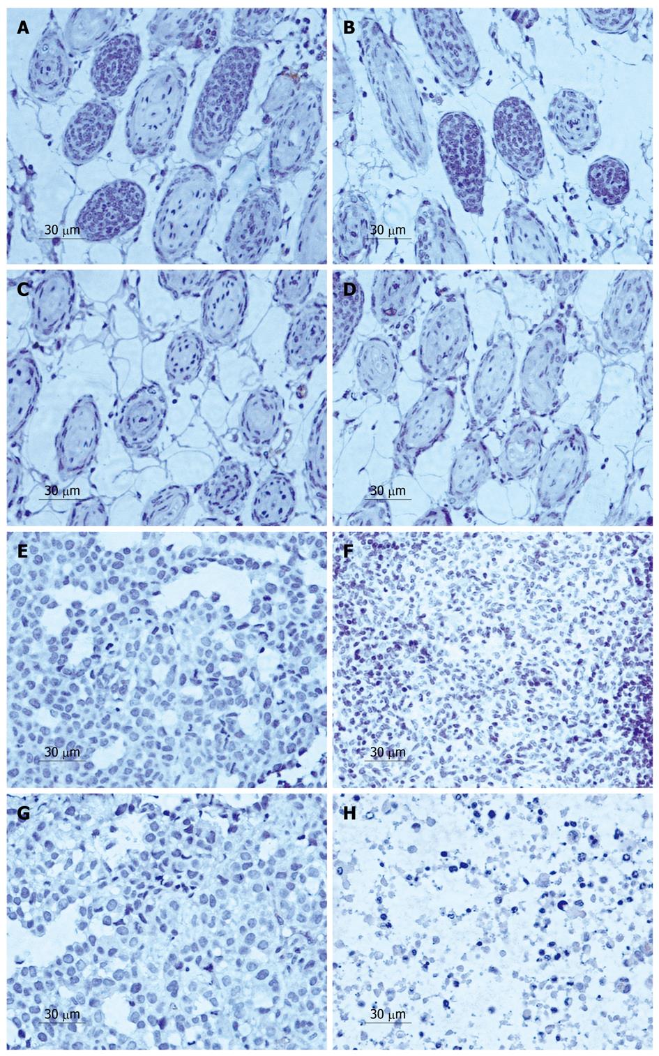 Effects of LY294002 on the invasiveness of human gastric 