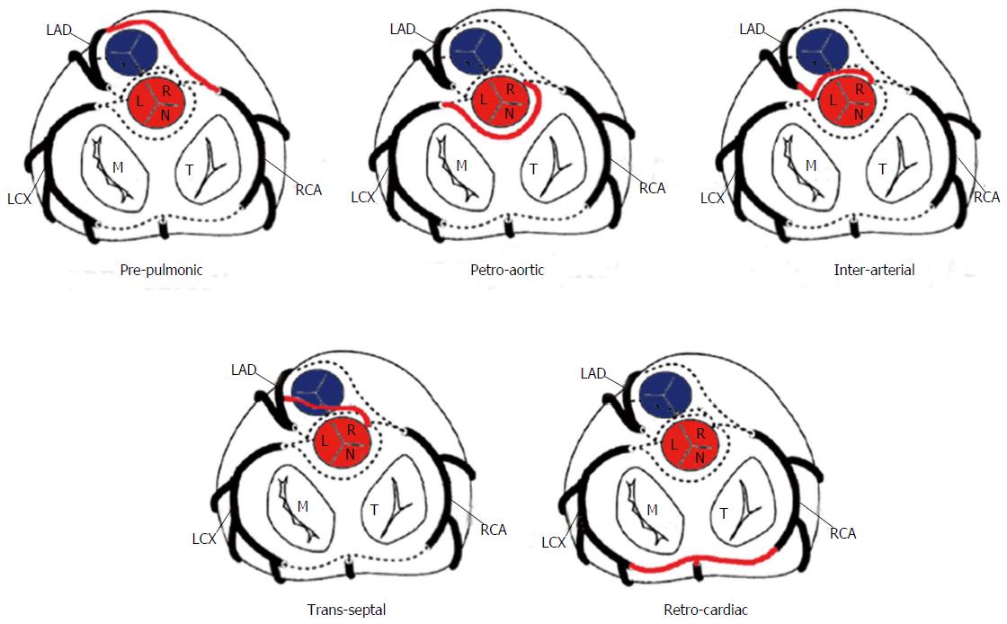 Anatomy, descriptive and applied. Anatomy. 556 THE VASCULAR SYSTEMS The  anterior cardiac veins open into the lower fore part of the right auricle.  The right auriculoventricular opening, or the tricuspid orifice {