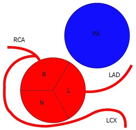 Coronary Artery Anomalies Overview The Normal And The Abnormal