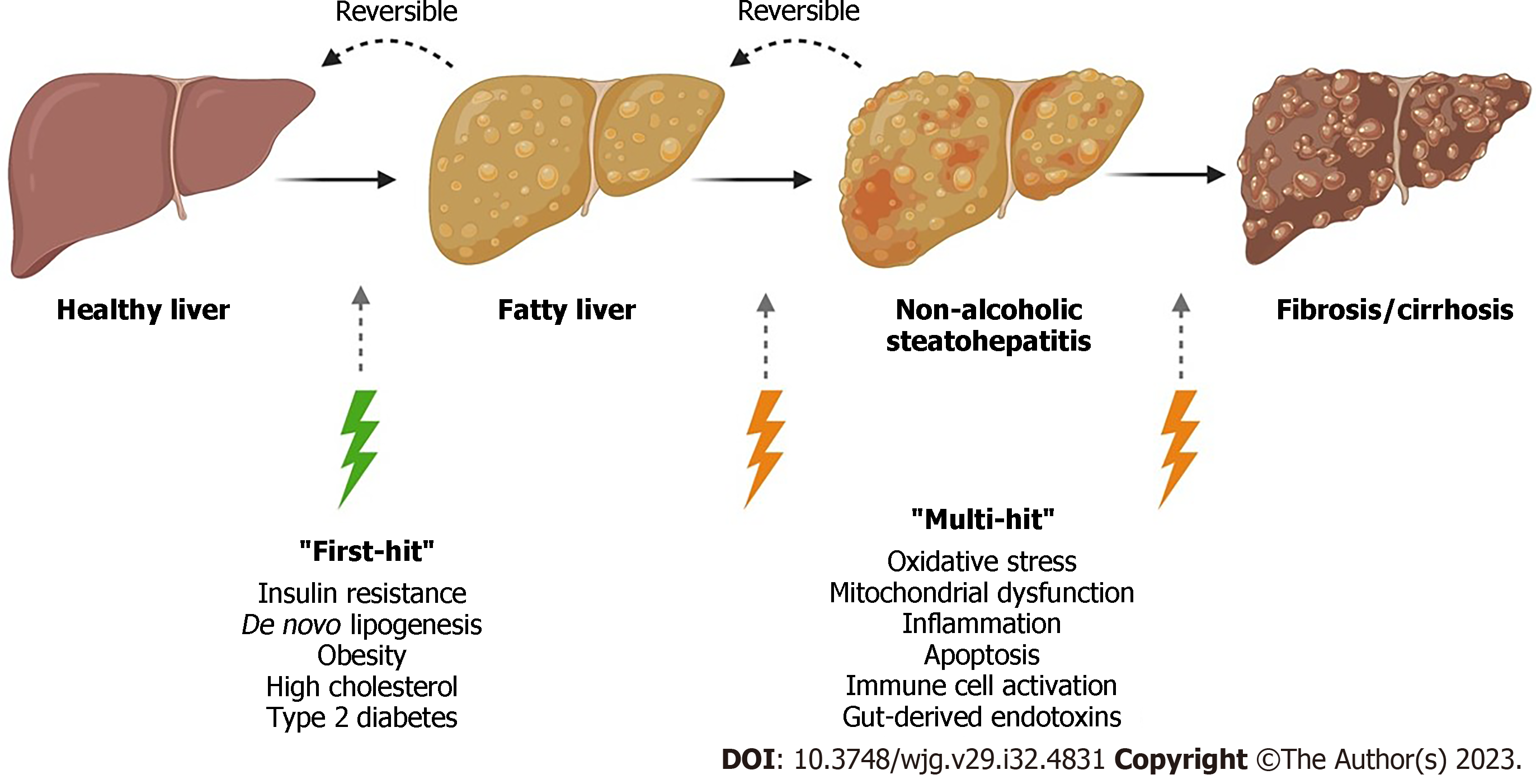 Non-alcoholic fatty liver disease: Immunological mechanisms and current ...