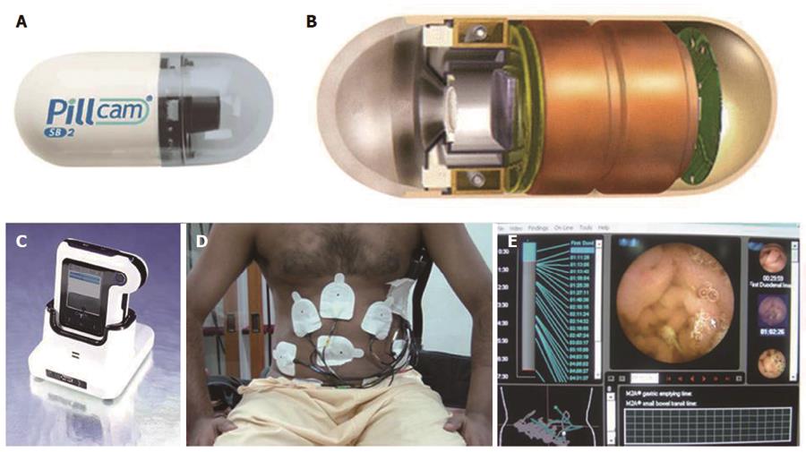 Capsule Endoscopy Belt