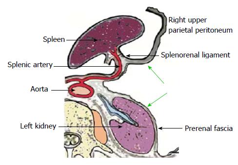 Comprehensive treatment for the peritoneal metastasis from gastric cancer