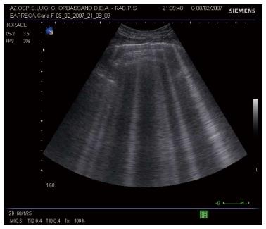 chf lung sounds