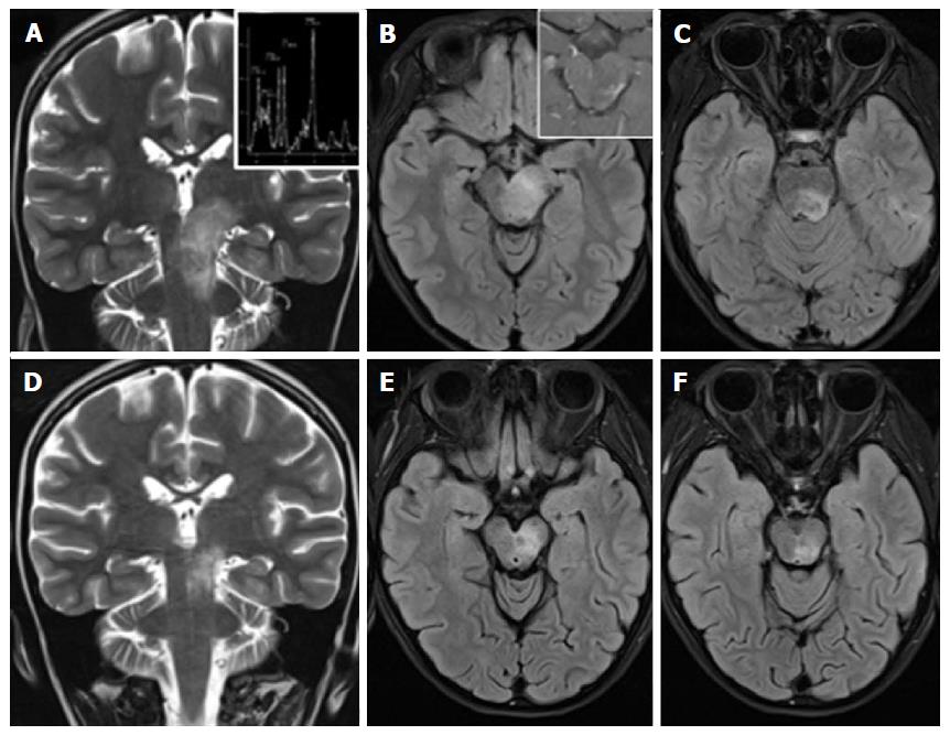 Area Postrema Mri Anatomy