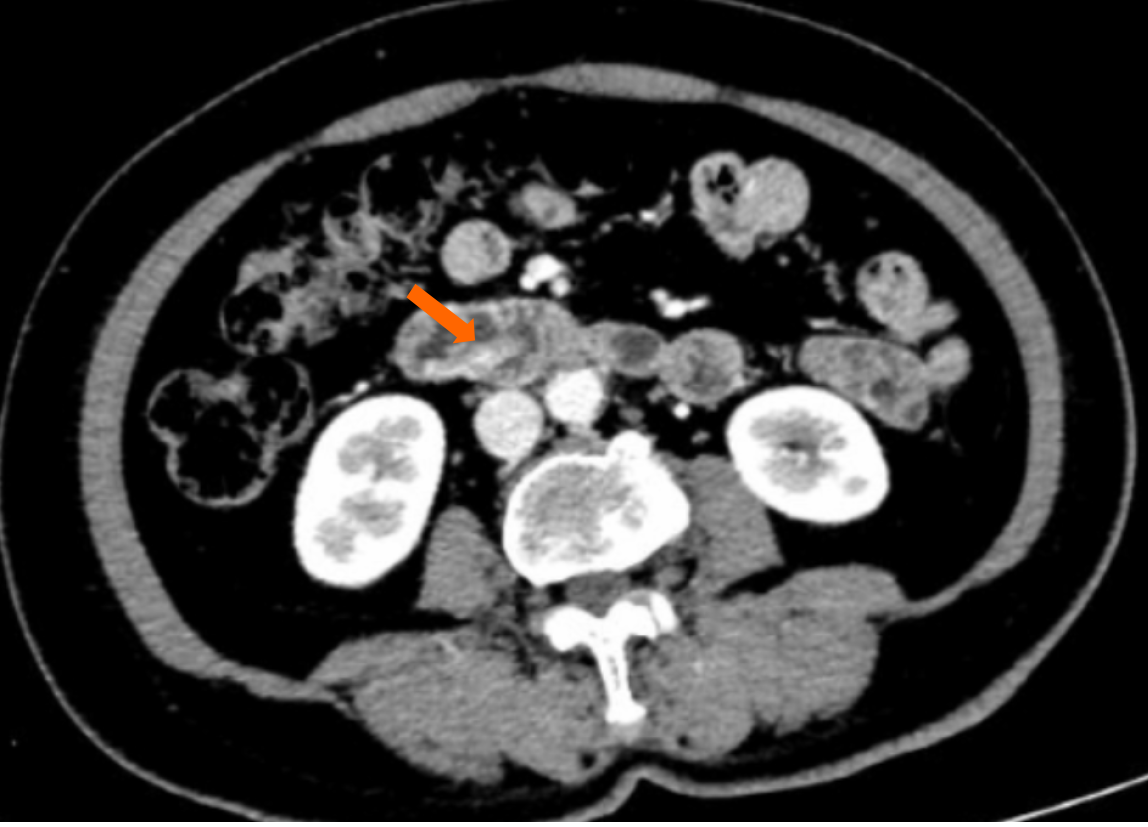 Figure 1 Figure 1