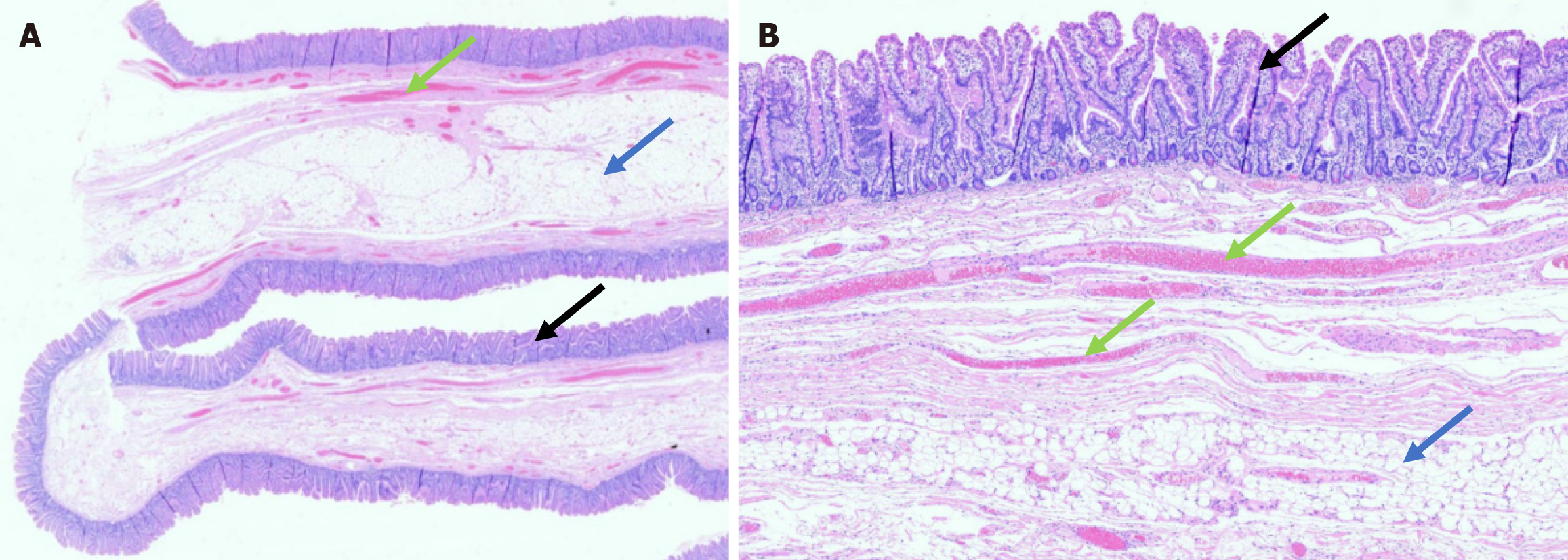 Figure 3 Figure 3
