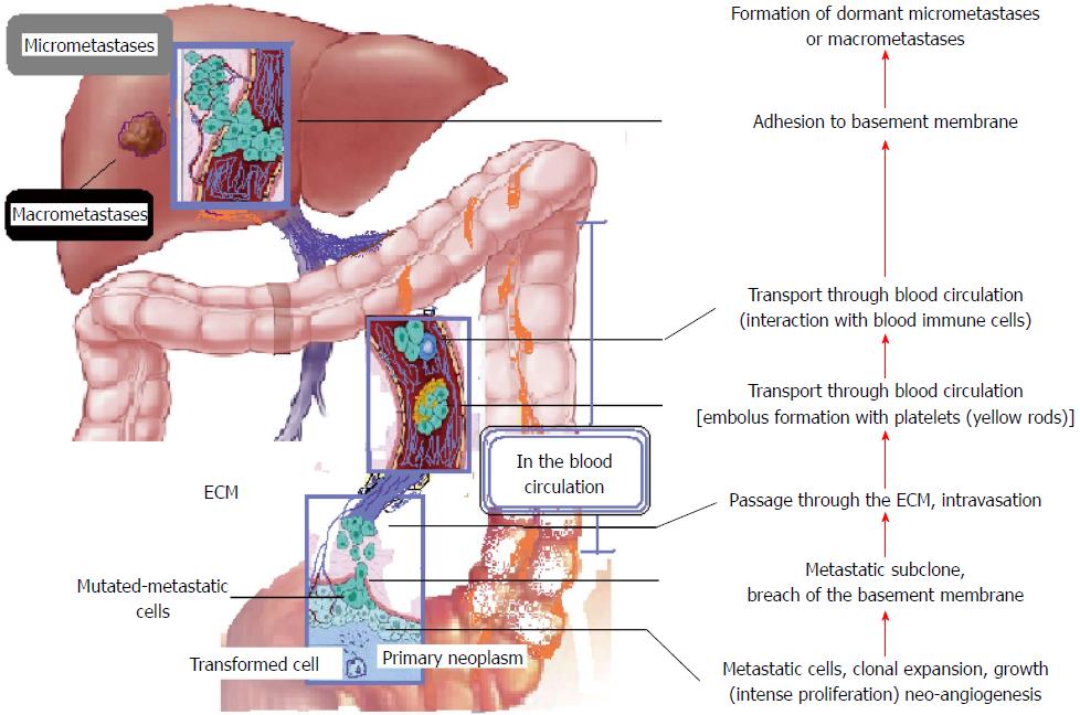 metastatic cancer in colon)