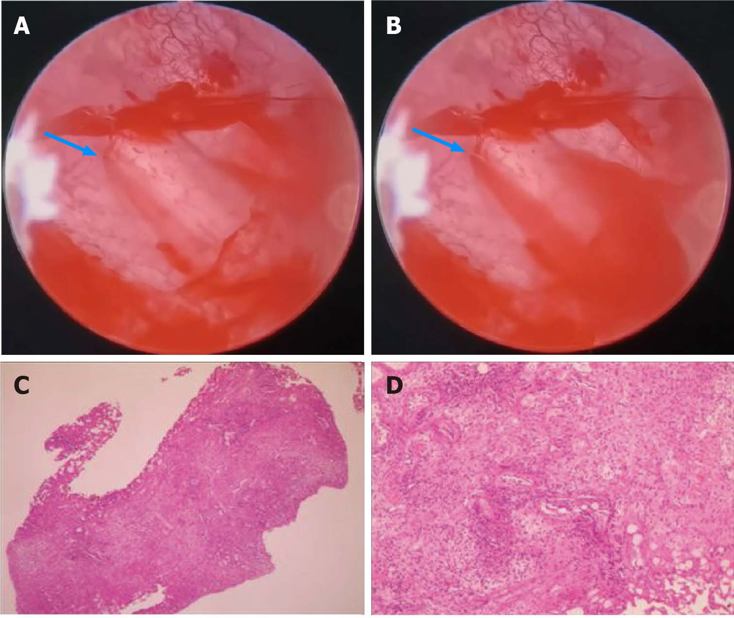 HC | Shaanxi BLOOM Tech Co., Ltd HC | Shaanxi BLOOM Tech Co., Ltd