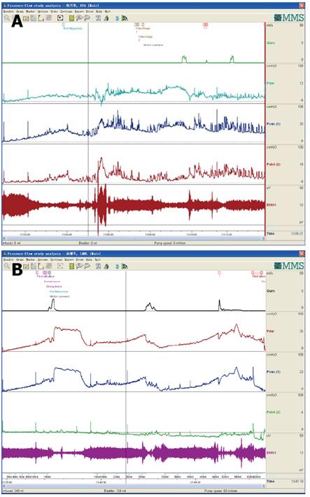 Comprehensive urodynamics: Being devoted to clinical urologic practice