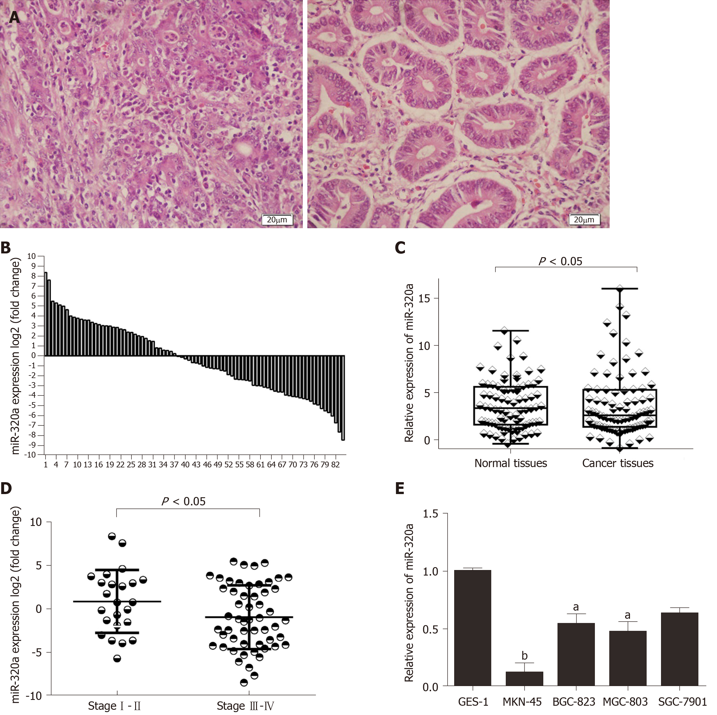 Microrna 3a Suppresses Tumor Progression By Targeting Pbx3 In Gastric Cancer And Is Downregulated By Dna Methylation
