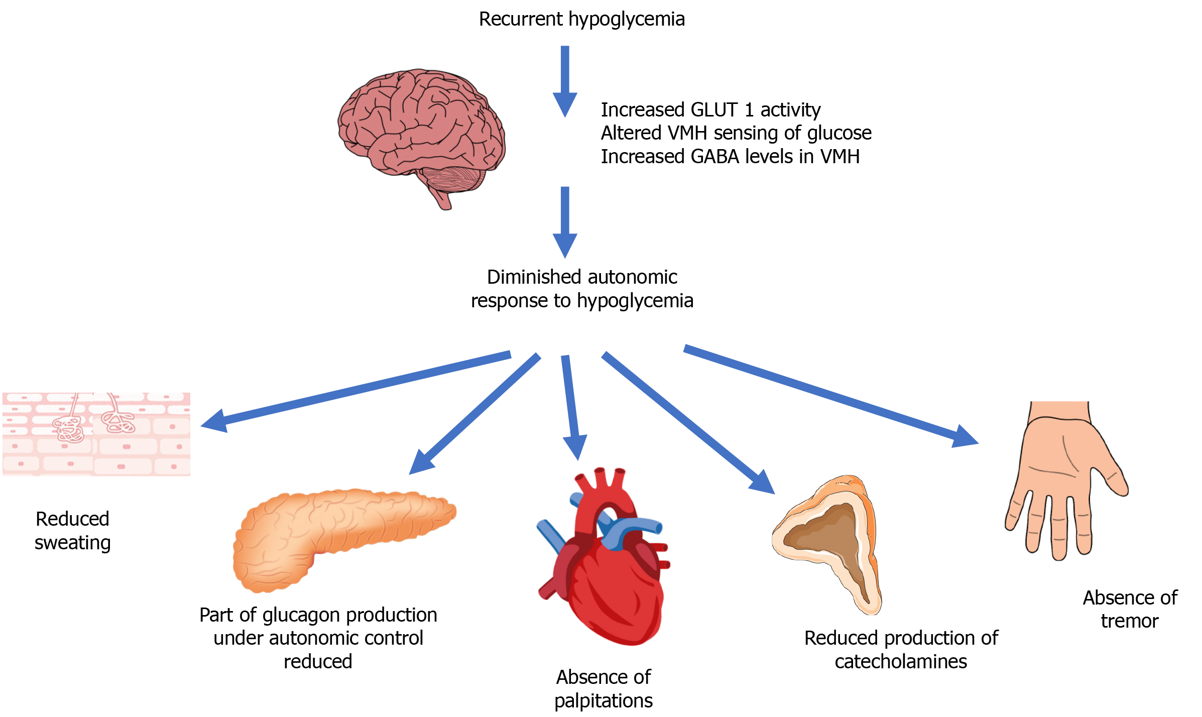Hypoglycemia Unawareness