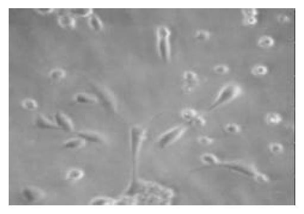 In vitro cultivation of human fetal pancreatic ductal stem cells 