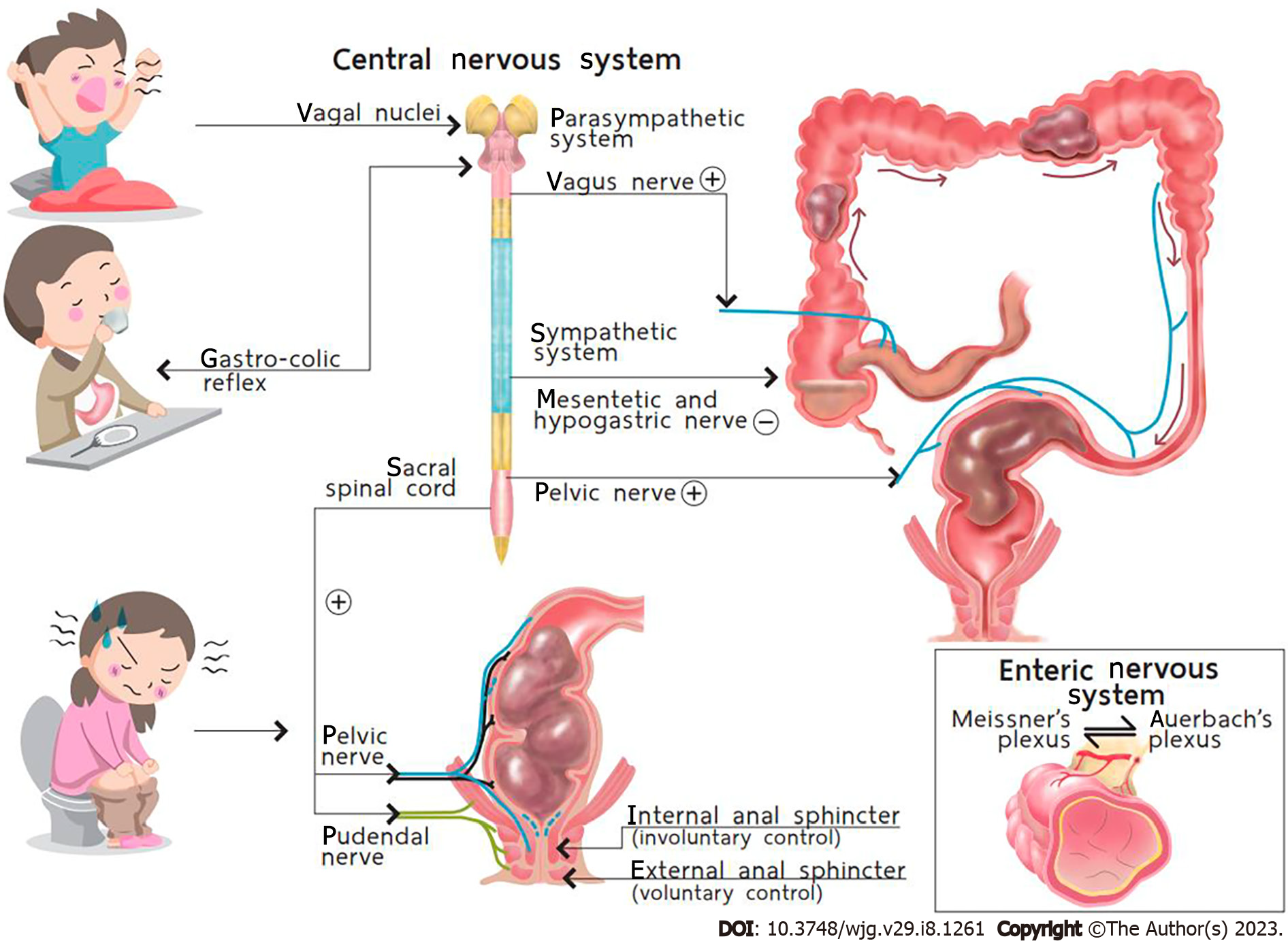 Fecal Impaction What Is It Causes Treatment And More 48 OFF