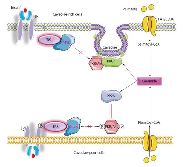 Defect of insulin signal in peripheral tissues: Important role of 