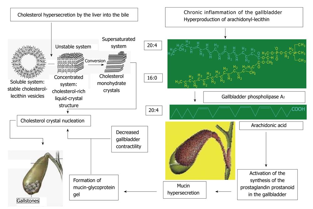 Pathophysiology Of Cholelithiasis In Flow Chart