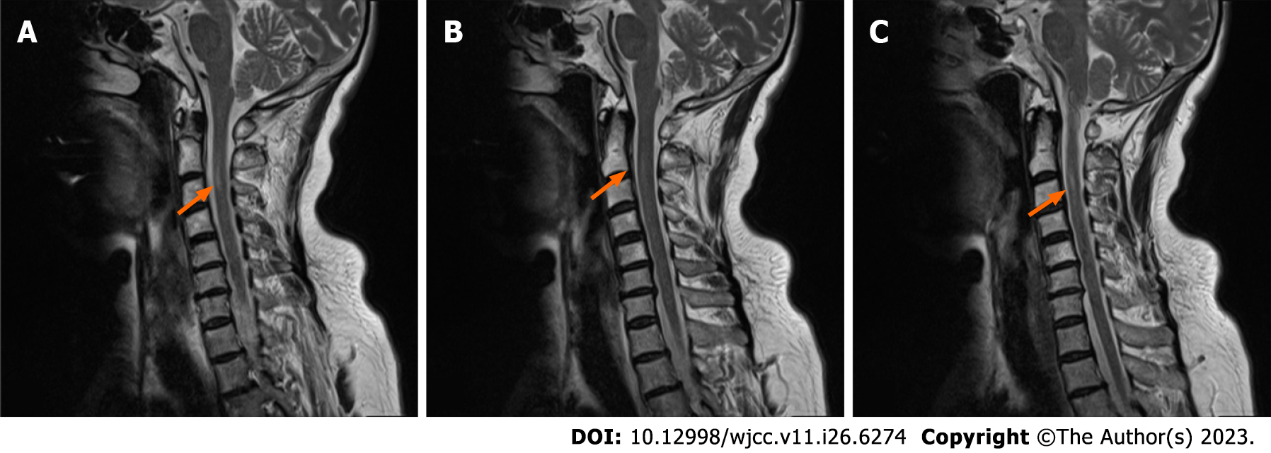 Antibody Test For Guillain Barre At Brandon Banks Blog