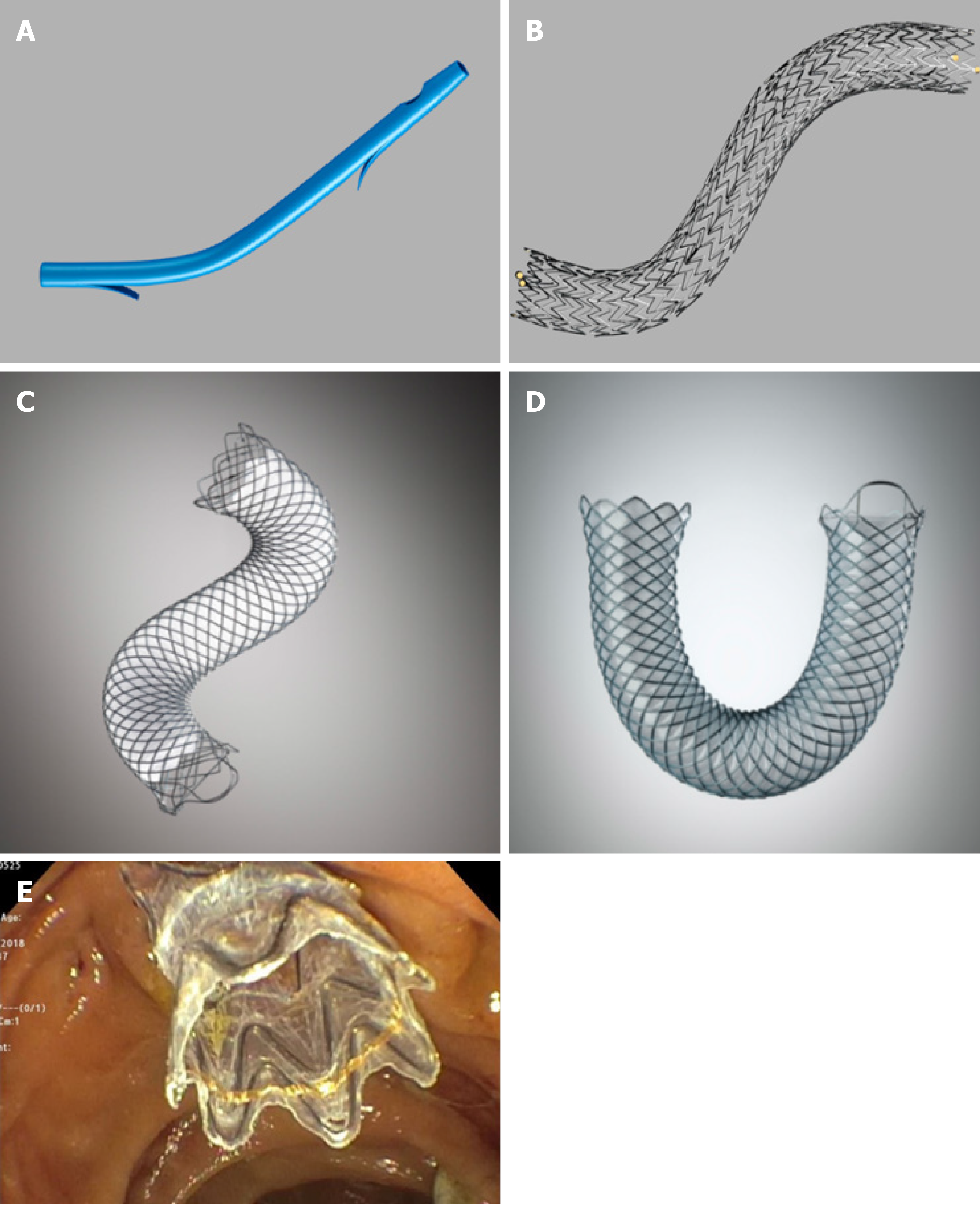 ercp stent