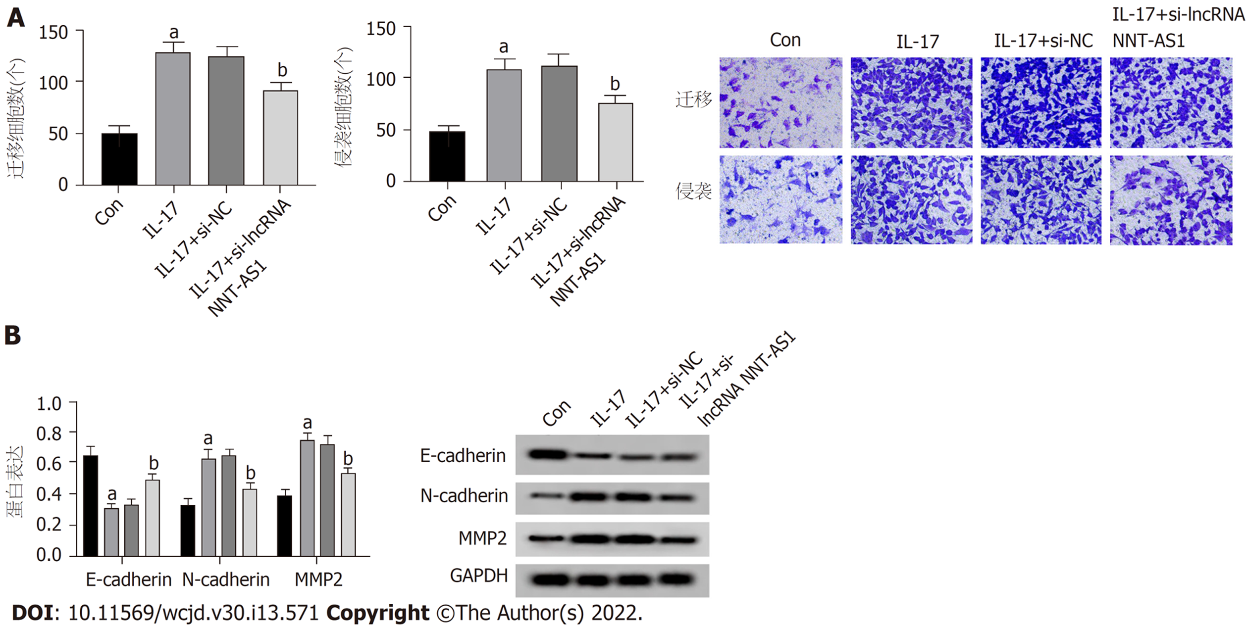 lncRNA NNT-AS1调控miR-518a-3p抑制IL-17诱导胃癌细胞增殖、迁移和侵袭 