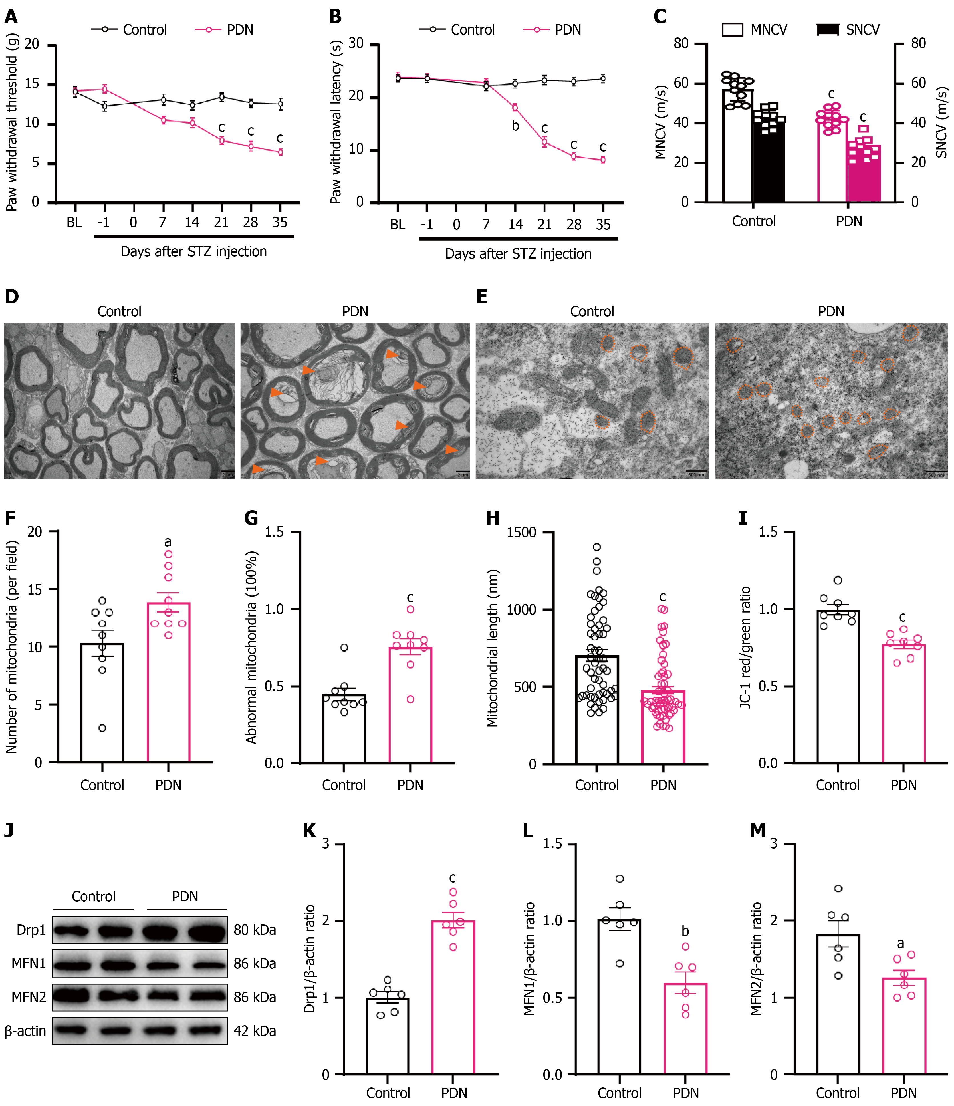 Preventive carnosine supplementation attenuates painful diabetic