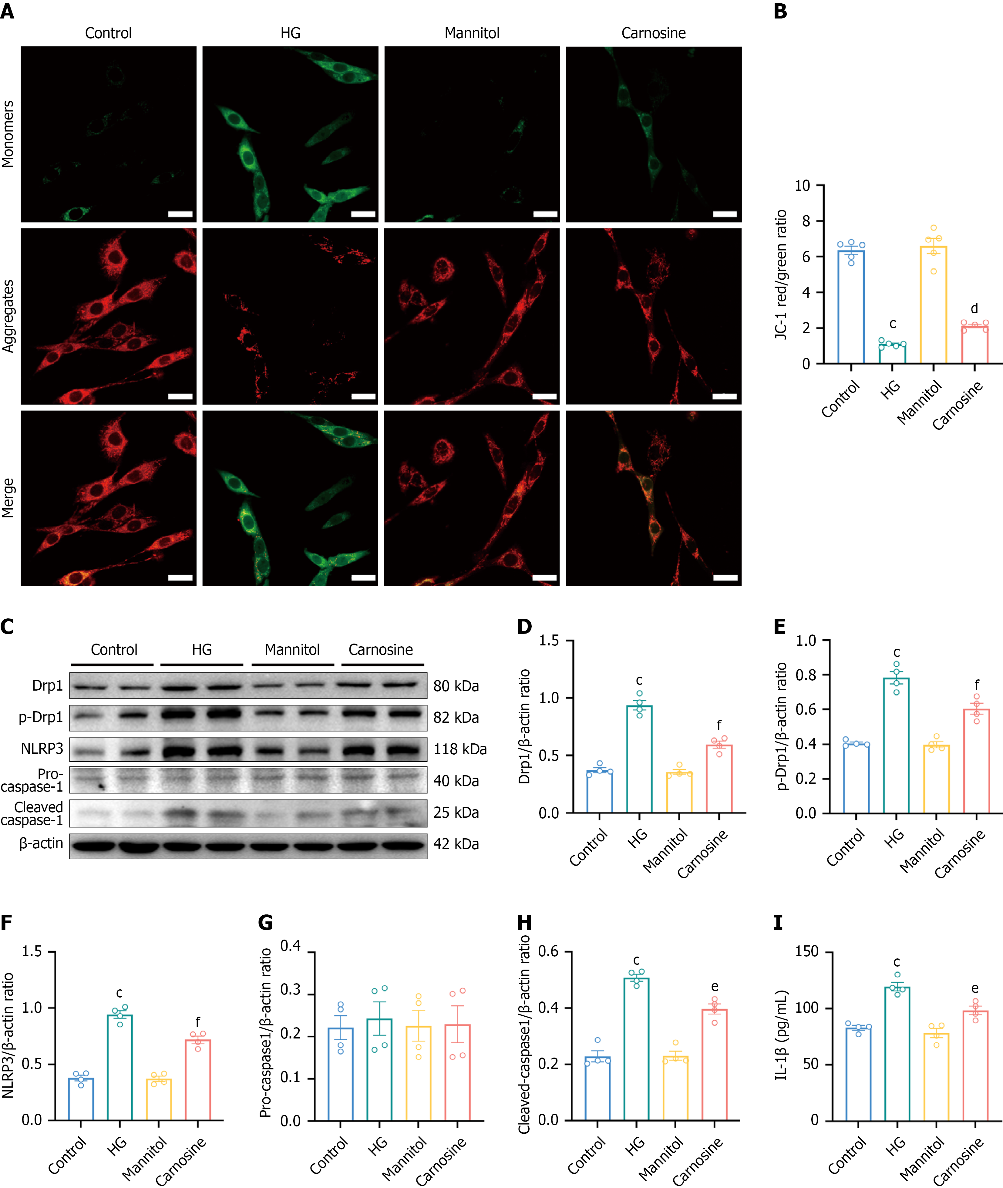 Preventive carnosine supplementation attenuates painful diabetic
