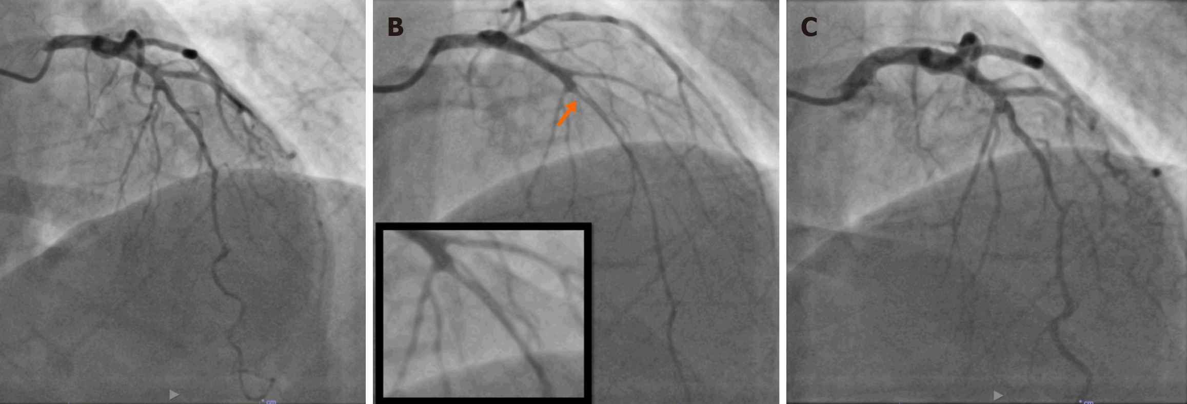 Figure 3 Figure 3