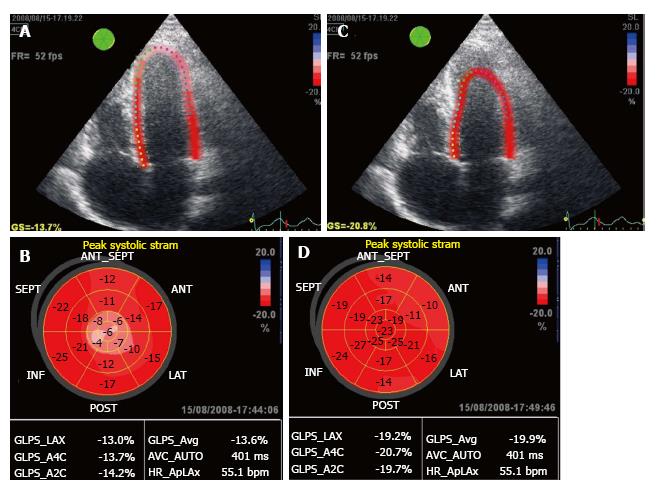 Strain Echocardiography by speckle tracking and tissue Doppler -Part  I:technique 