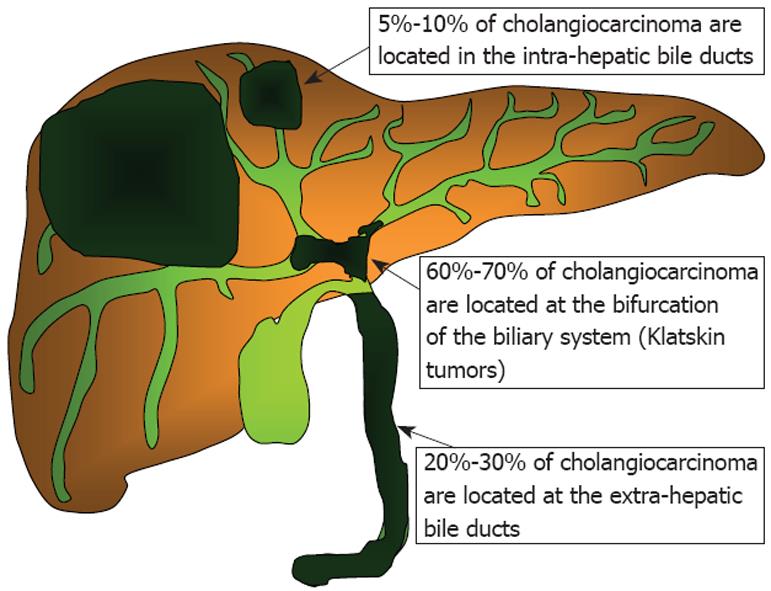 Cholangiocarcinoma Type