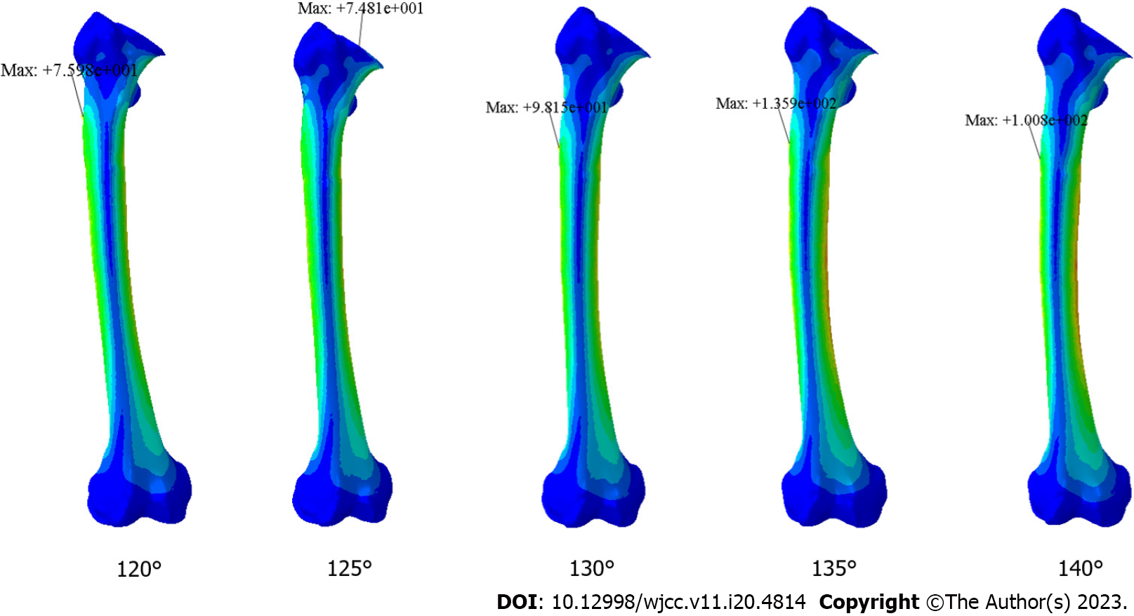Analysis of contact pressure in a 3D model of dual-mobility hip joint  prosthesis under a gait cycle