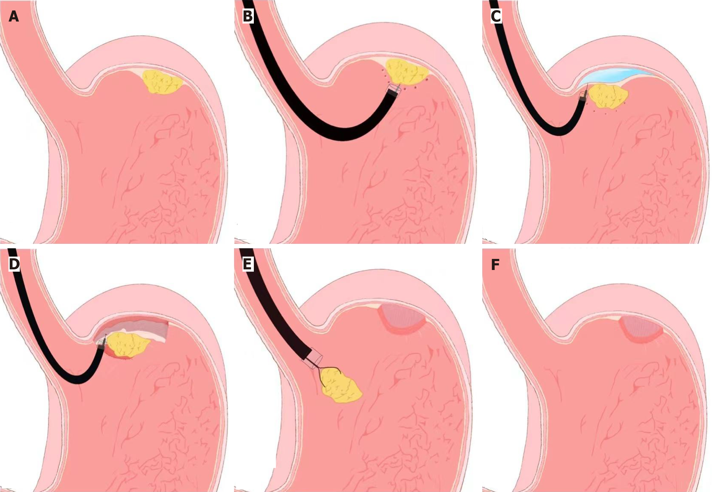 Figure 1 Figure 1