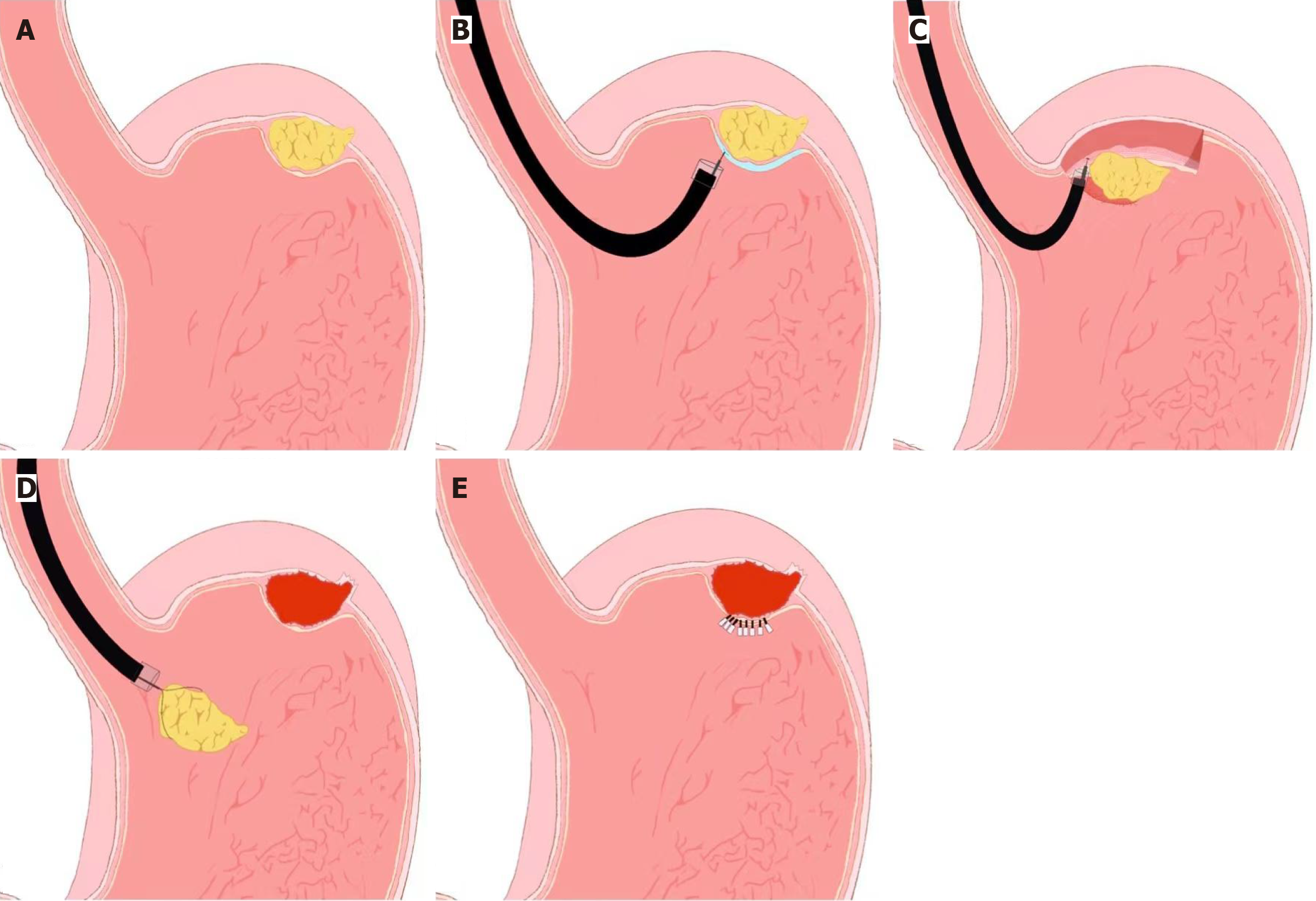 Figure 2 Figure 2