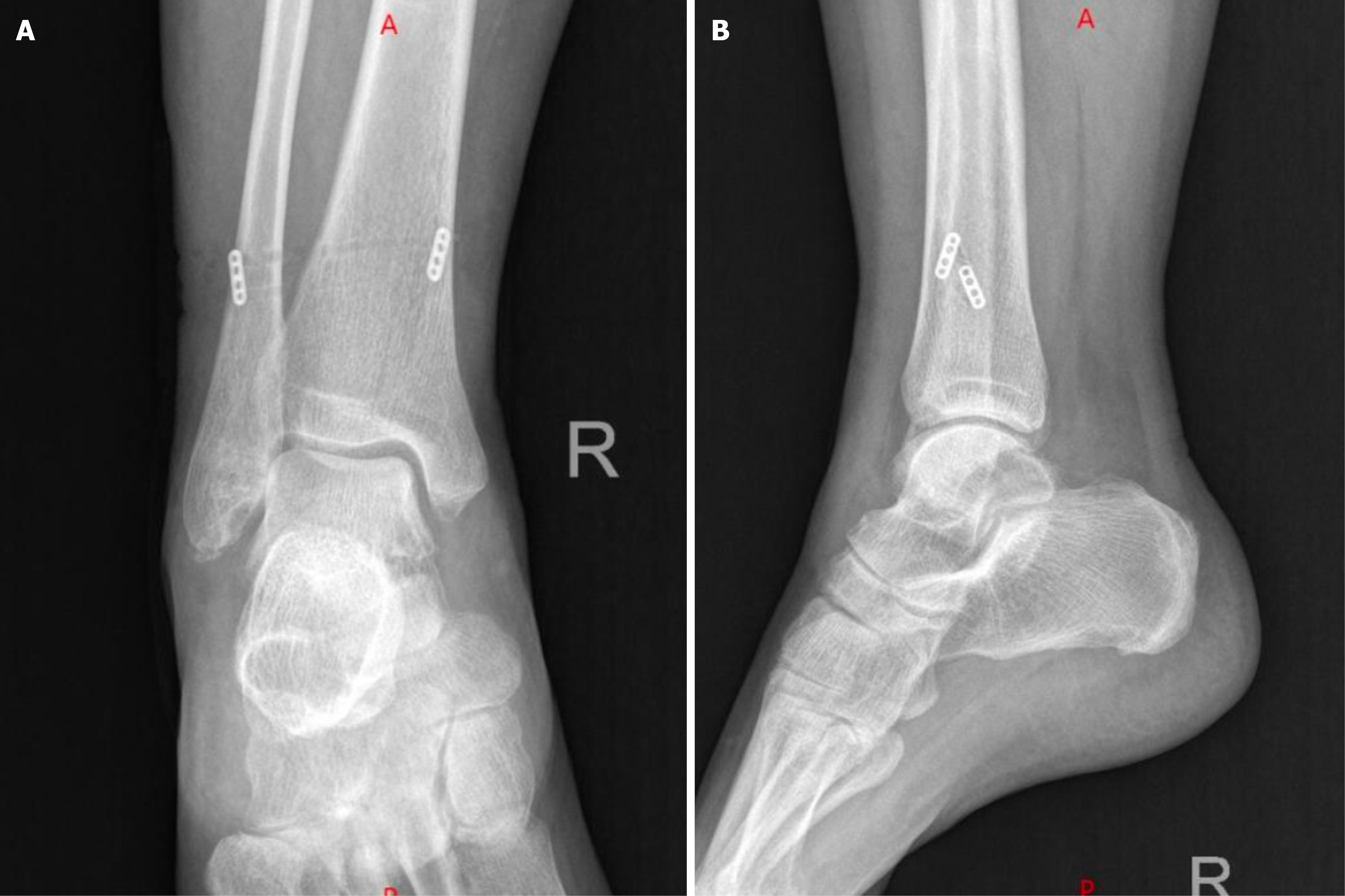Figure 6