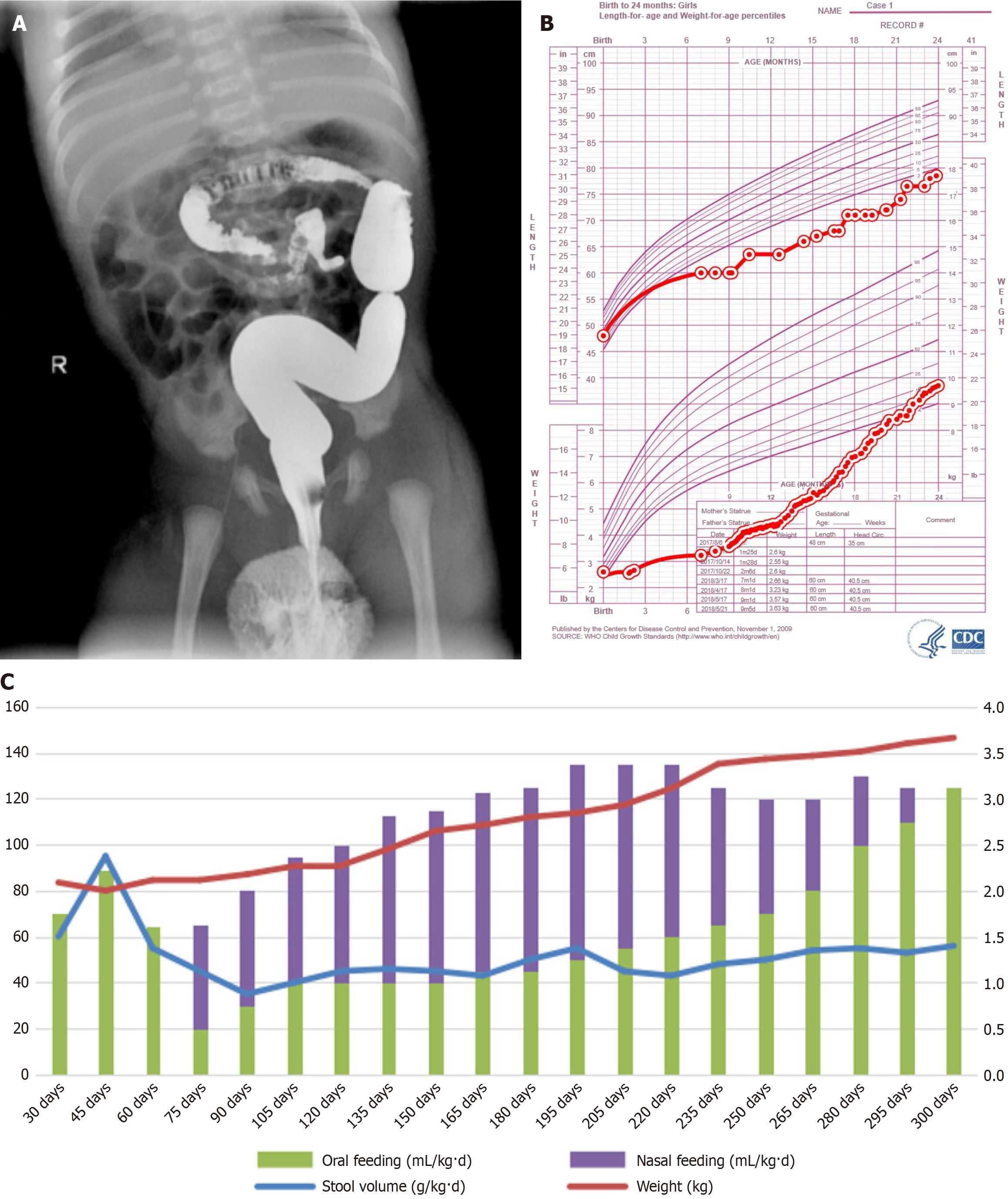Figure 1 Figure 1