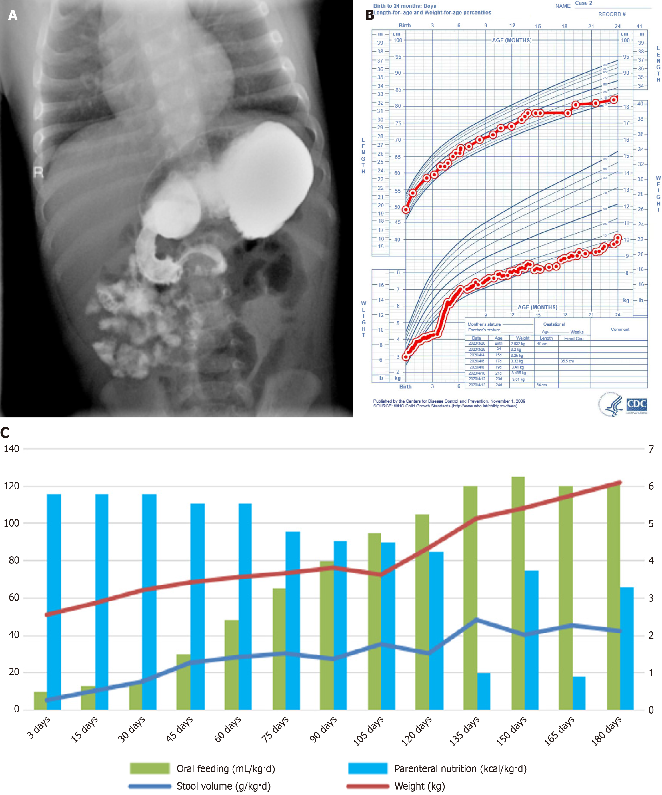 Figure 2 Figure 2