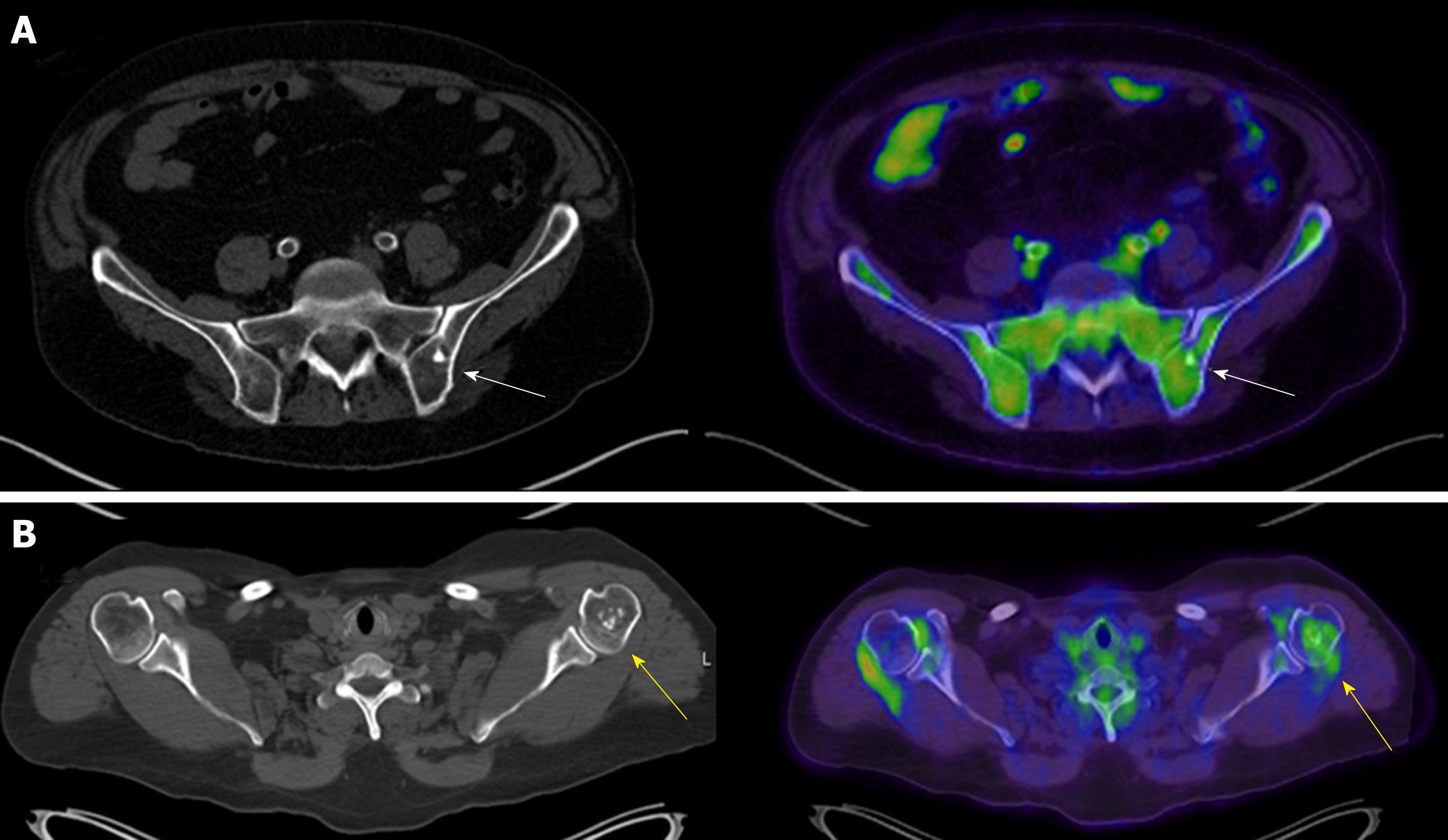 Manyetik rezonans görüntüleme ( MRI ) nedir? 