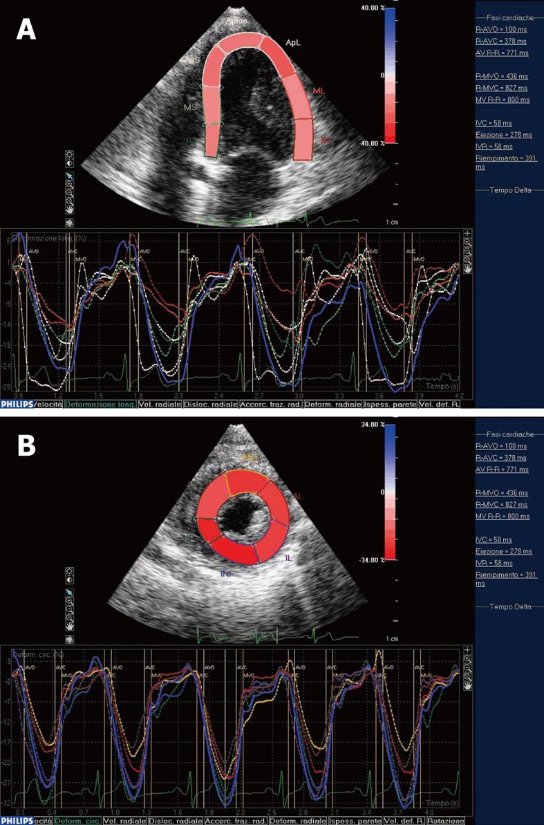 From apical views, longitudinal myocardial strain can be calculated. In