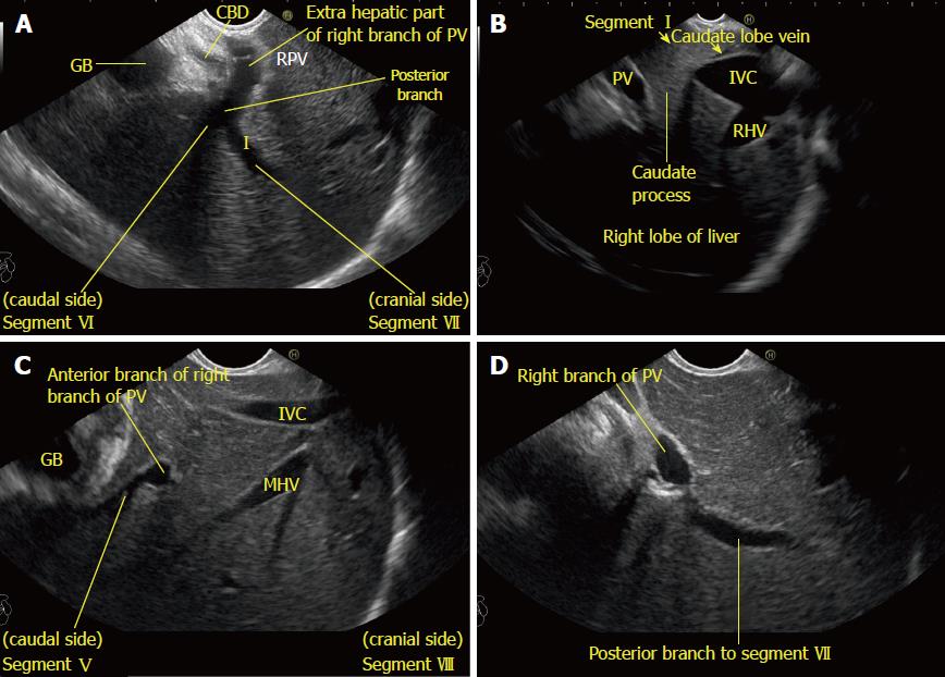 liver ultrasound anatomy
