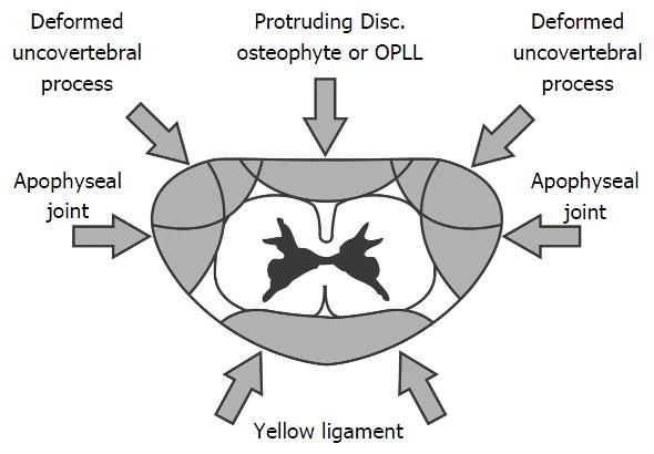 can cervical myelopathy cause death