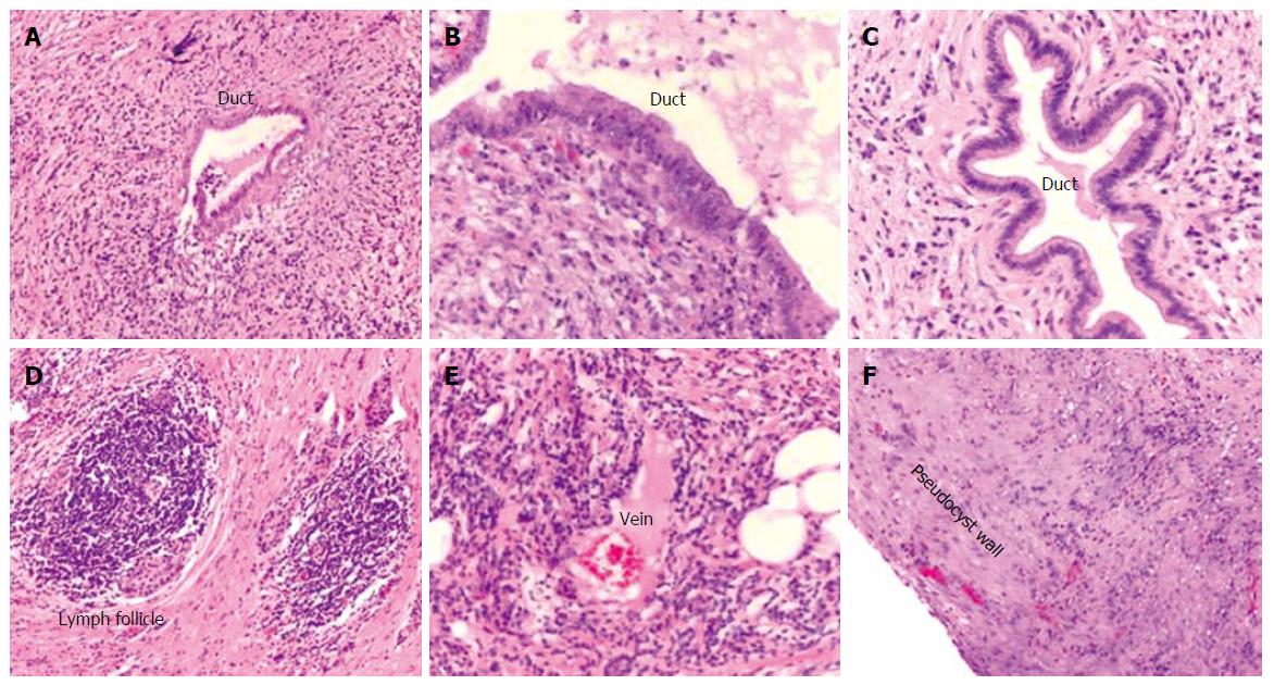 pancreatic pseudocyst histology